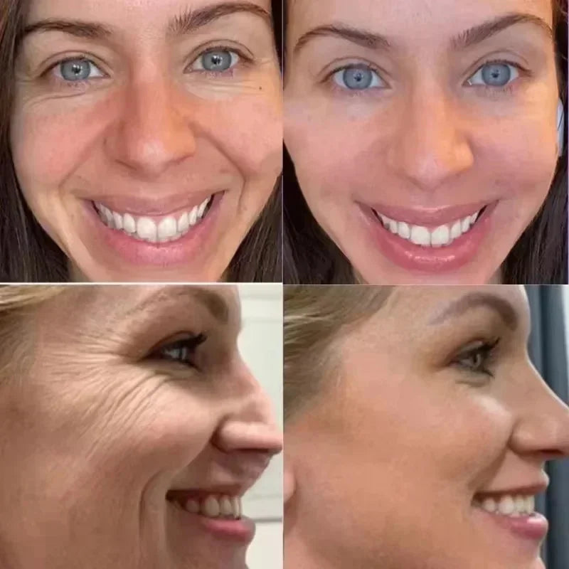 GlowFix™ – Instant Youth Skin Adhesive